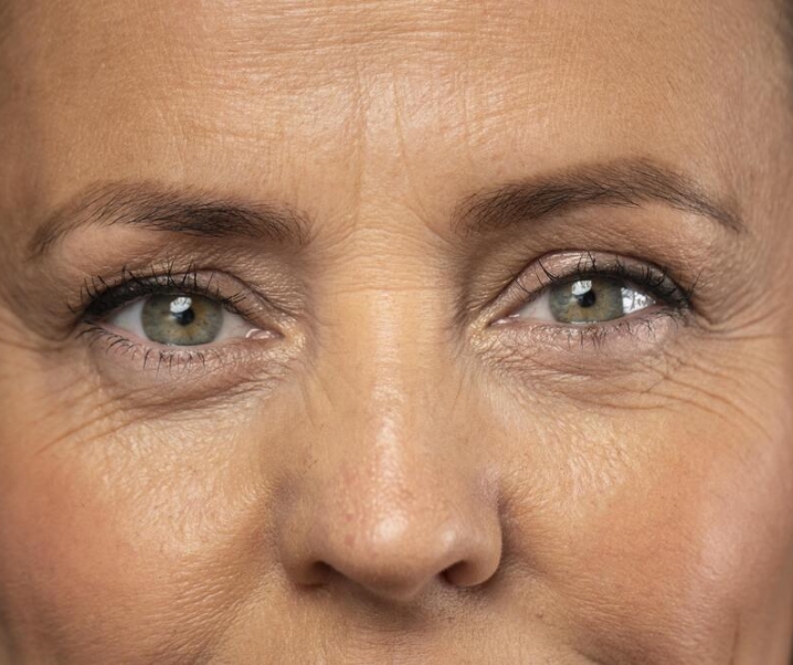 Rekomendasi 5 Produk Eye Cream untuk Atasi Kantung Mata
