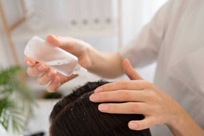 scalp-treatment